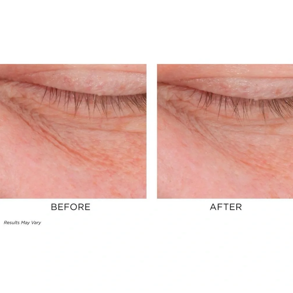 Perricone MD Cold Plasma Plus+ Advanced Eye Cream NIB